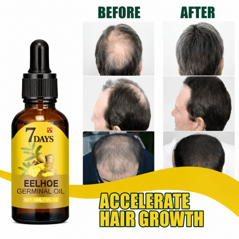 Hair Growth Oil - Phantyo