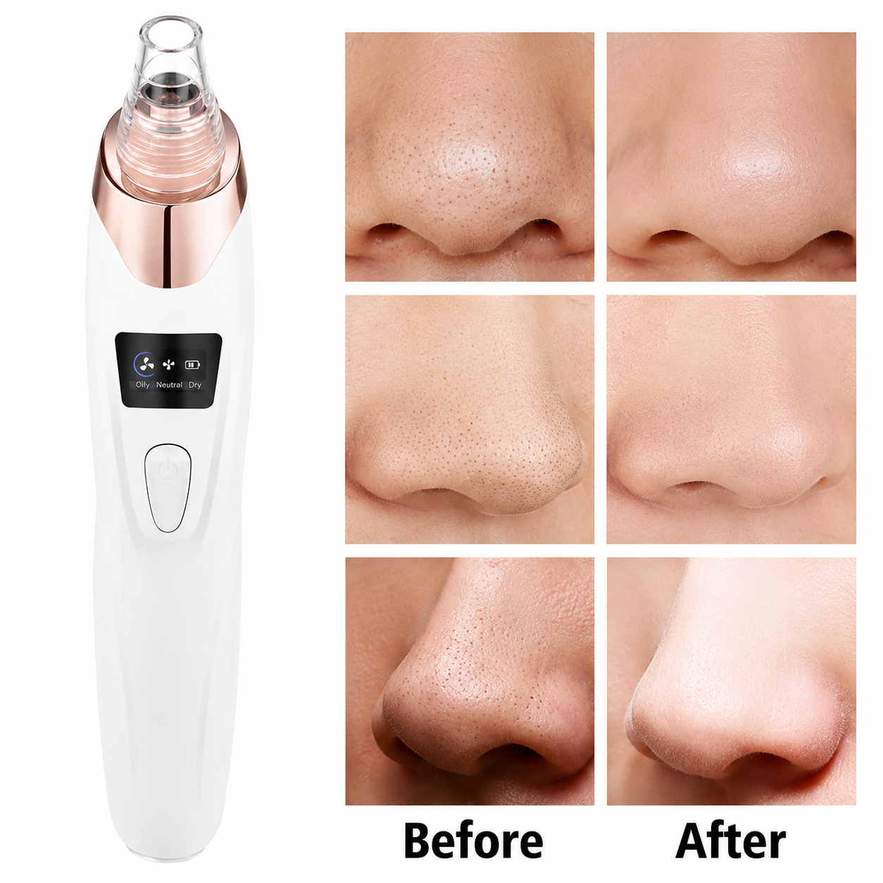 Pore Vacum