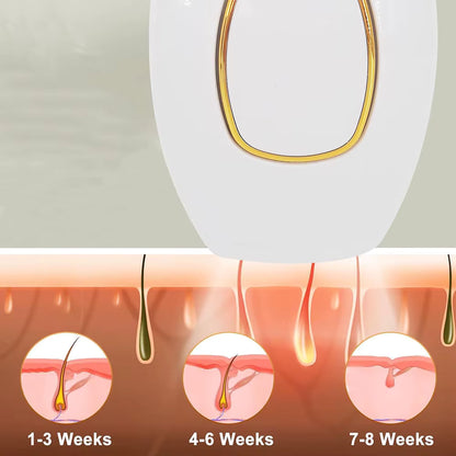 IPL Hair Removal