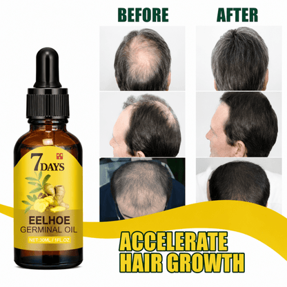 Hair Growth Oil - Phantyo